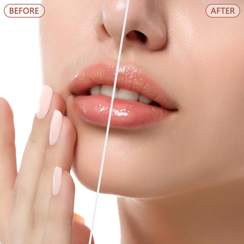 Facial Hair Remover P885