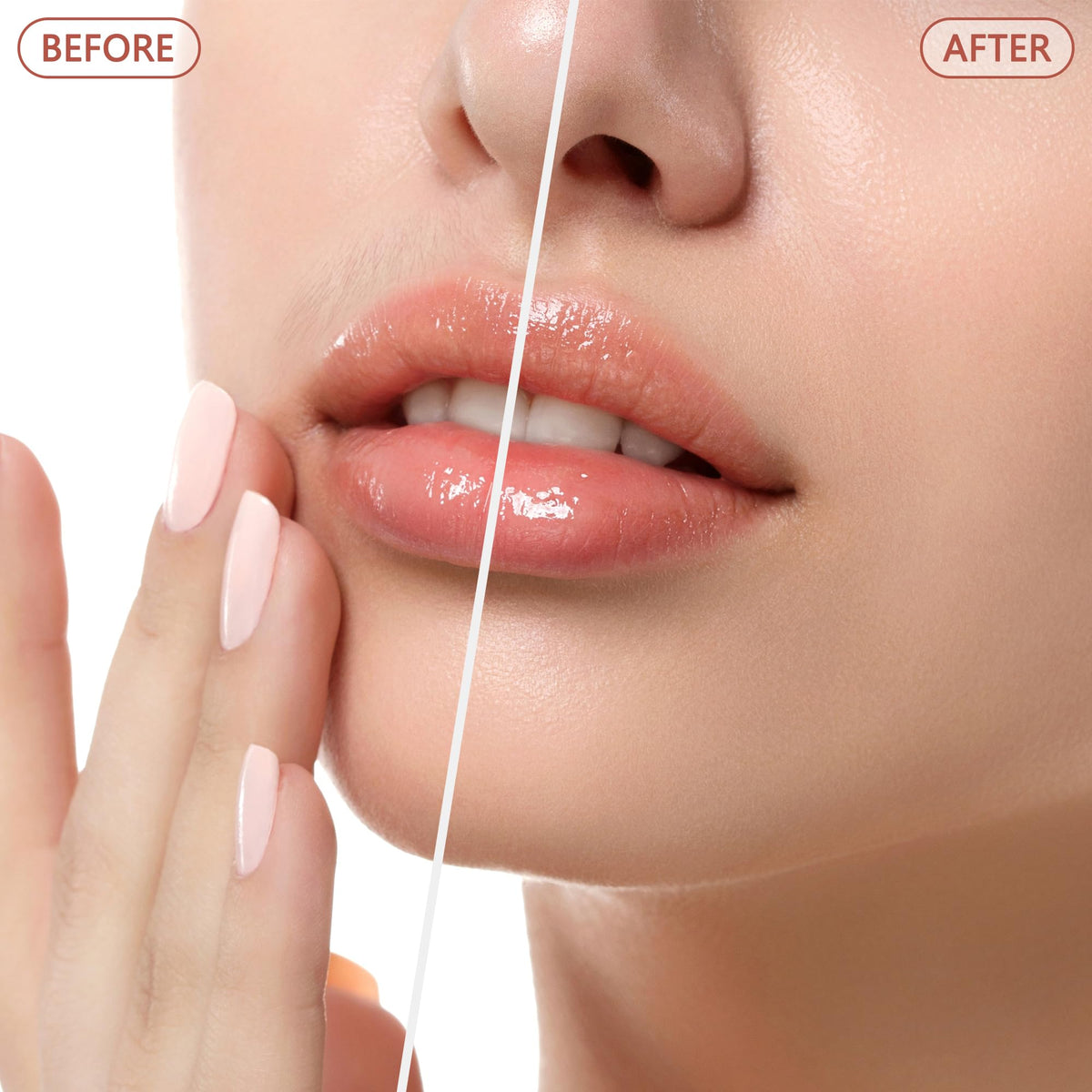 Facial Hair Remover P885